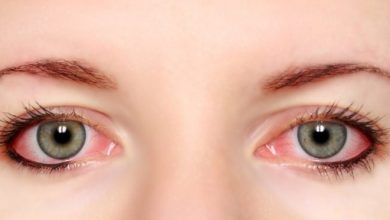 قطرة عين ايزوبتو سيتاميد محلول معقم لعلاج العدوى الحادة المزمنة