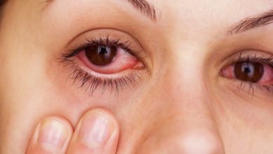 دواء اوكولوتوب لعلاج الالتهابات البكتيرية من العيون والالتهابات الجلدية Oculotob