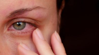 قطرة توبراميسين مضاد حيوي لعلاج الالتهابات في العين الخارجية Tobramycin