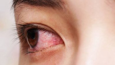 مرهم تيترا لعلاج التهابات العين والعدوى البكتيرية Tetra eye ointment