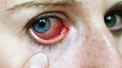 قطرة سامولجين مسكن و مضاد لإلتهابات العين فى حالات الكدمات و الألم SAMULGIN