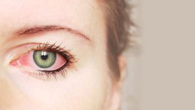 التهابات العين البكتيرية ما هي انواعها وافضل طرق الوقاية منها