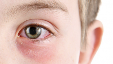 أبرز الادوية لعلاج التهابات العين البكتيرية وتعرف علي اسباب العدوي البكتيرية بالعين