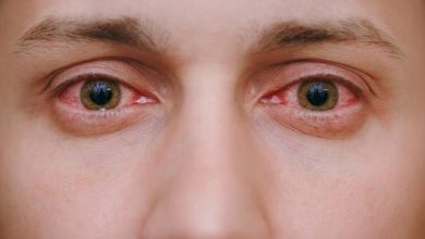 تعرف علي افضل انواع القطرة التي تعالج حساسية العين و اعراض الاصابة بها
