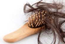 الاسباب الشائعة لتساقط الشعر عند النساء والرجال والفرق بين التساقط الطبيعي والغير طبيعي