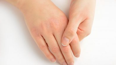 أفضل الطرق للتخلص من تشقق اليدين وأهم النصائح للوقاية من جفاف وخشونة اليدين