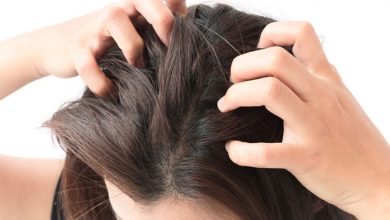 التعرف على اسباب ظهور القمل فى الشعر وافضل الادويه لعلاجه