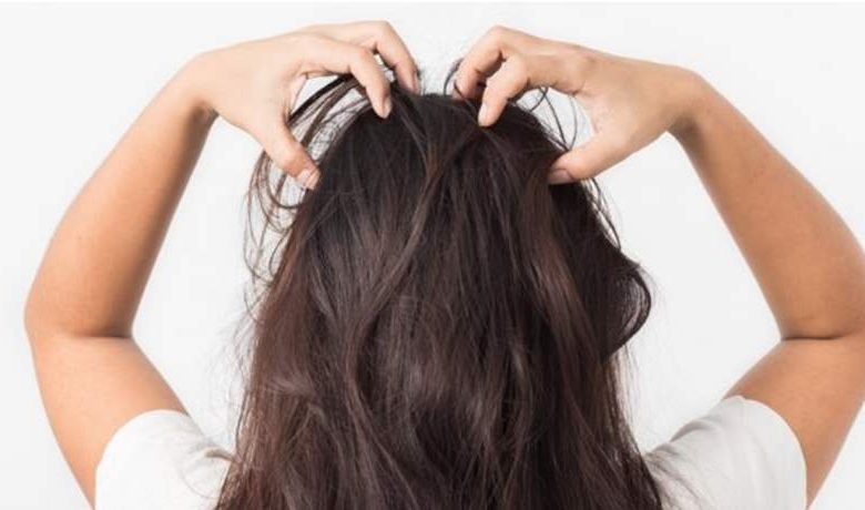 التخلص من اكزيما الشعر و افضل الطرق الفعاله لعلاجها
