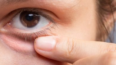 علاج حبوب العين و اهم النصائح للوقايه منها