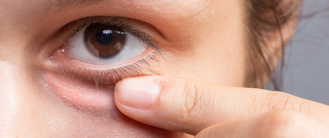 علاج حبوب العين و اهم النصائح للوقايه منها