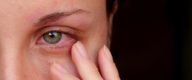 افضل نوع قطره لالتهابات العين البكتيريه و اهم اسبابها