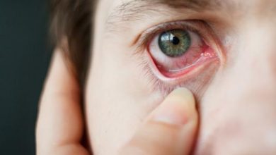 طرق علاج عماص العين بالطرق المنزلية والعلاجية وكيفية التعامل معه