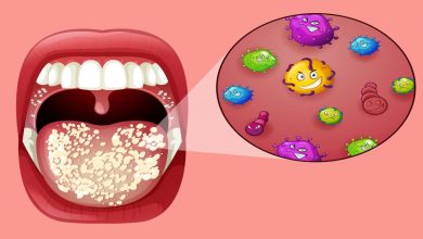 الوقاية من فطريات الفم وافضل النصائح لعلاجها والتخلص منها