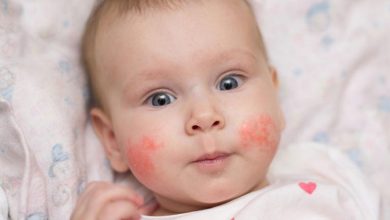 اسباب حساسية الجلد عند الاطفال وطرق علاجها ونصائح لتجنب الاصابة بها
