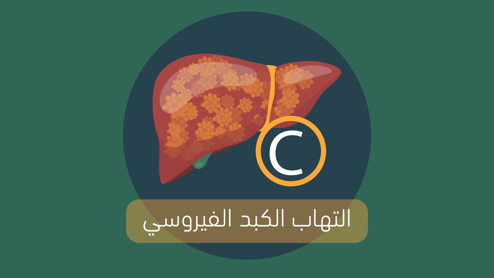 مرض التهاب الكبد الوبائي سي ابرز الاعراض وطرق العلاج وكيفية الوقاية من ...
