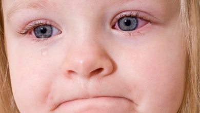 احمرار العين عند الاطفال اليك اهم الاسباب وافضل الطرق لعلاجها