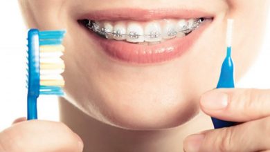 اثار تقويم الاسنان فى الفم و افضل الادويه التى تعالج فطريات الفم