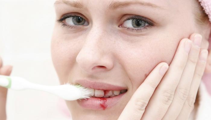 علاج التهاب اللثه فى الفم و اهم النصائح للوقايه من الاصابه به