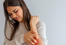 طرق طبيعيه للتخلص من لدغات الناموس و طرق الوقايه