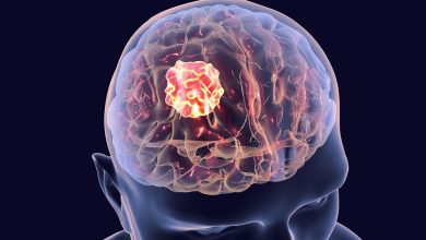 اعراض ورم المخ وكيفية تشخيص المرض وطرق التعامل معه
