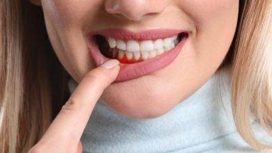 طرق طبيعية للتخلص من التهاب اللثة في الفم والعناية بصحة الفم والاسنان